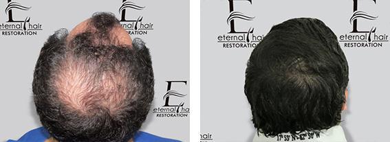 hair treatment result 2